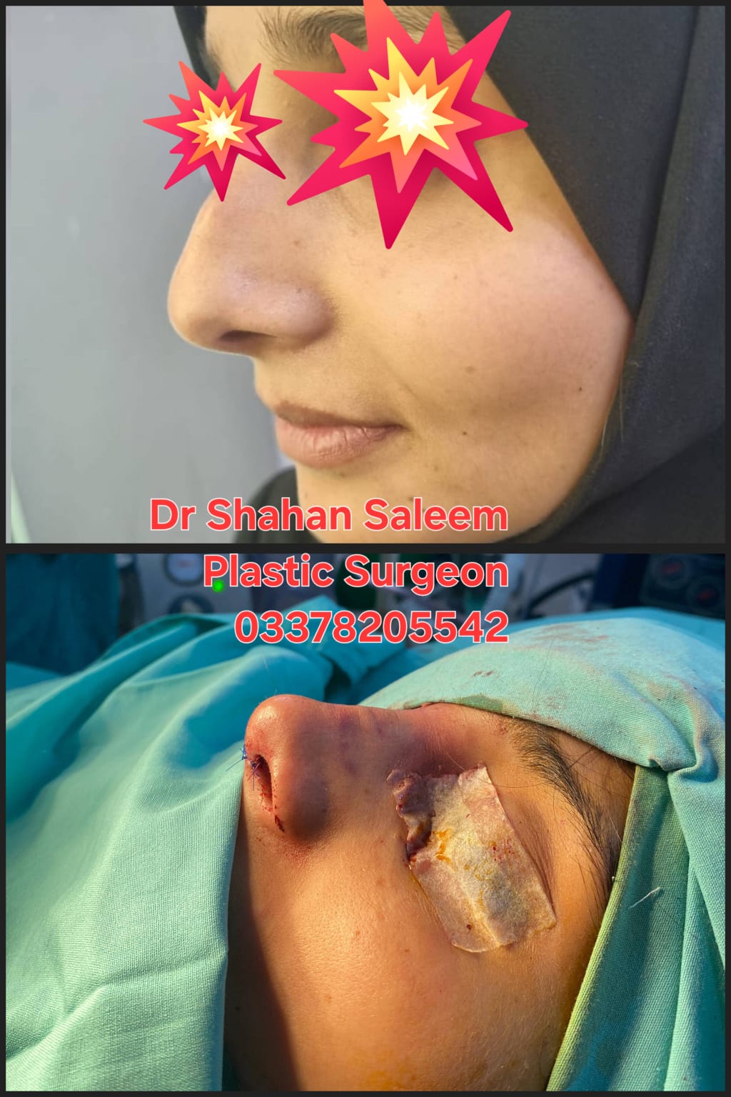 Before & After 61